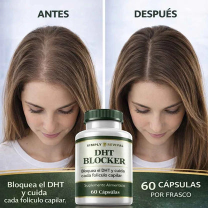 DHT ANTICALVICIE - Apoyo Integral para un Cabello Más Fuerte y con Mejor Apariencia